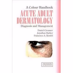 ISBN Acute Adult Dermatology : Colour Handbook, Educational, English, 192 pages