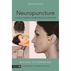 UBC Press Neuropuncture, Paperback, 168 pages