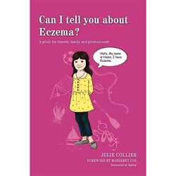 UBC Press Can I tell you about Eczema?, Paperback