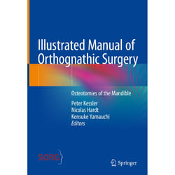 ISBN Illustrated Manual of Orthognathic Surgery book English Hardcover 360 pages