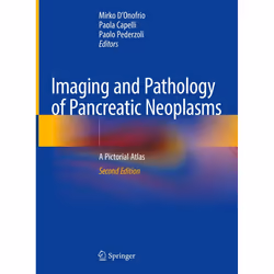 ISBN Imaging and Pathology of Pancreatic Neoplasms, English, Hardcover, 543 pages