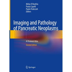 ISBN Imaging and Pathology of Pancreatic Neoplasms book English Hardcover 543 pages
