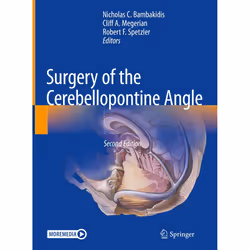 ISBN Surgery of the Cerebellopontine Angle, English, Hardcover, 424 pages